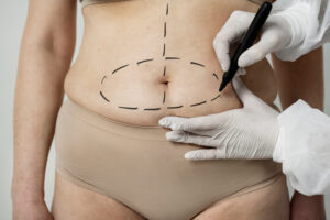 Cirurgia Plástica Reparadora: Como Conseguir Cobertura do Plano de Saúde